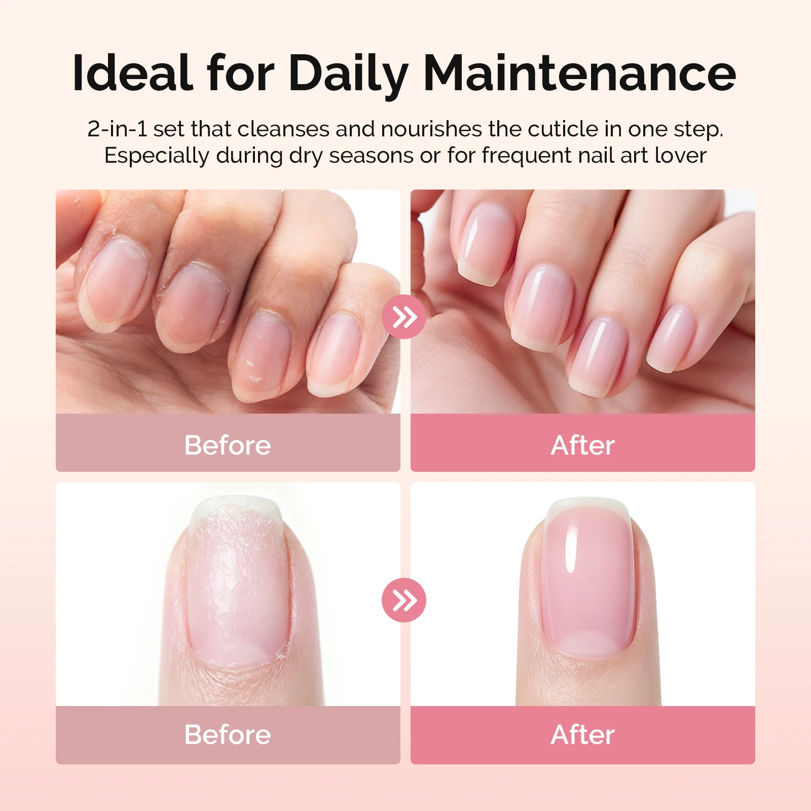 Cuticle Remover Kit - Image 3
