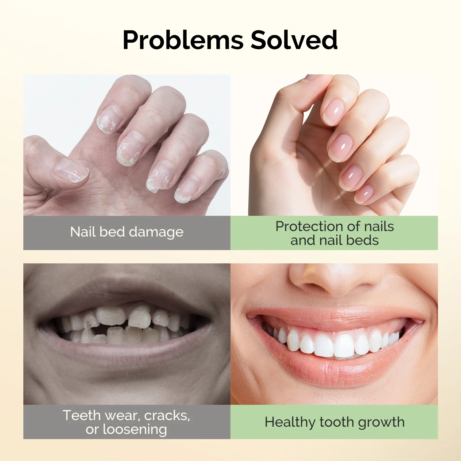Nail Biting Treatment 15ml - Image 4