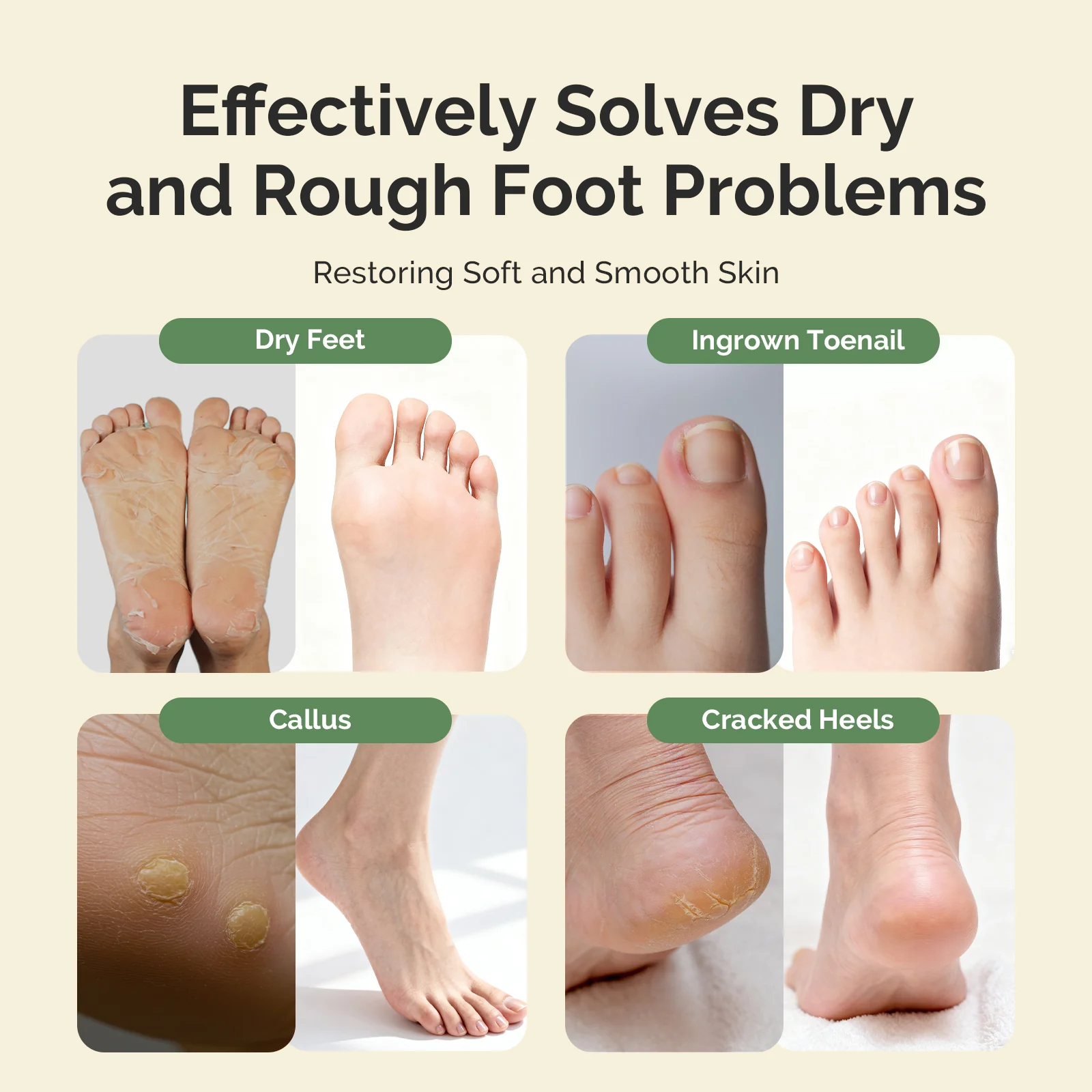 Tea Tree Oil Foot Soak with Sea Salt - Image 3